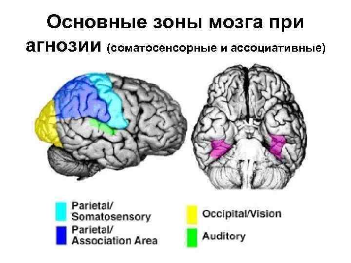 Недоразвитие зон мозга. Зоны мозга. Агнозия локализация поражения. Зрительные агнозии и поражения мозга. Соматосенсорные зоны мозга.