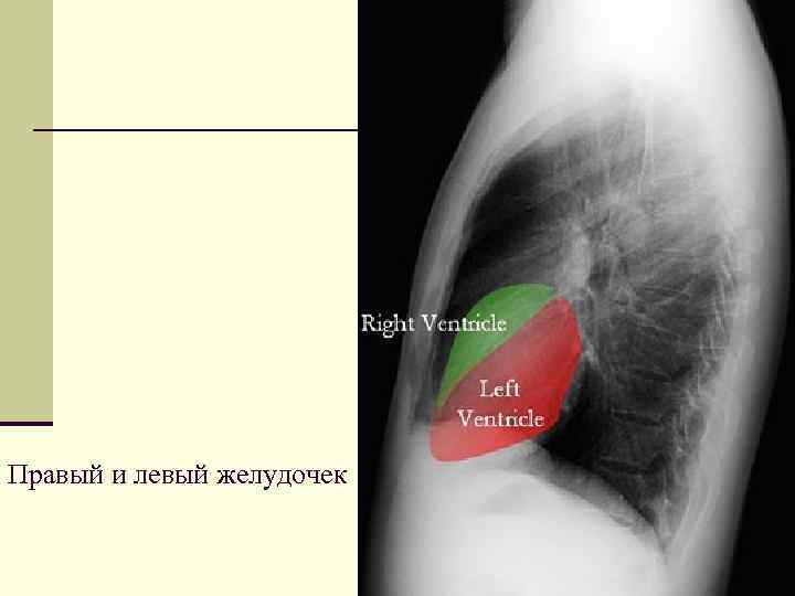 Правый и левый желудочек 