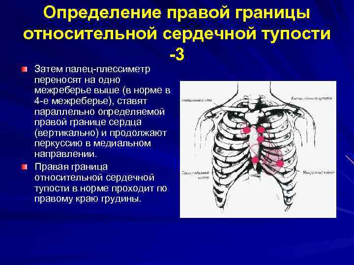 Тон шкоды при перкуссии