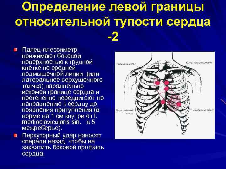 Относительная тупость сердца