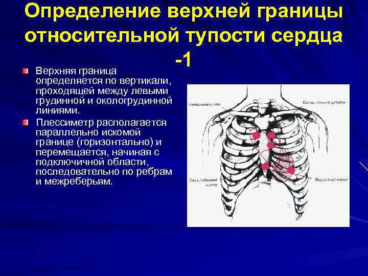 Левая граница относительной