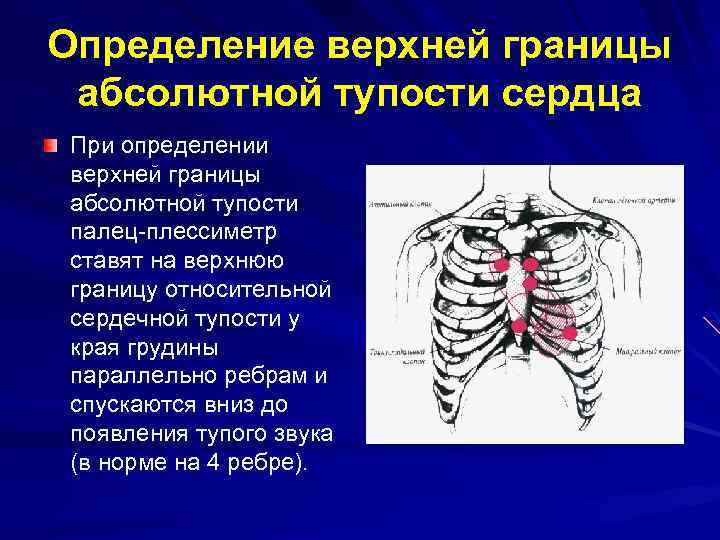 Границы относительной тупости сердца