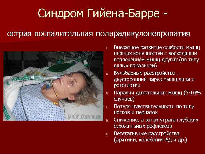 Синдром Гийена-Барре острая воспалительная полирадикулоневропатия ь ь ь Внезапное развитие слабости мышц нижних конечностей