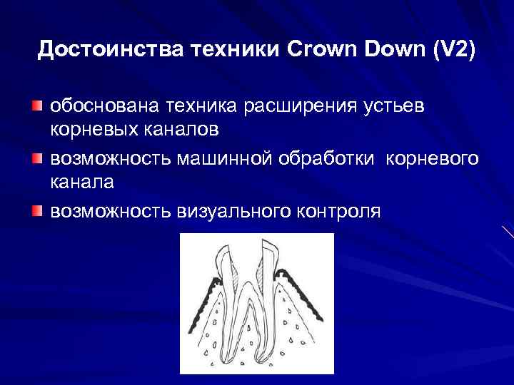 Техника расширения. Инструментальная обработка корневых каналов Crown down. Техника Crown down обработки корневых каналов. Методики расширения корневых каналов Crown down. Метод Crown down в стоматологии.