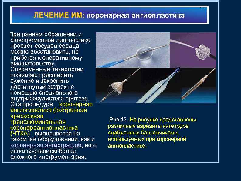 ЛЕЧЕНИЕ ИМ: коронарная ангиопластика При раннем обращении и своевременной диагностике просвет сосудов сердца можно