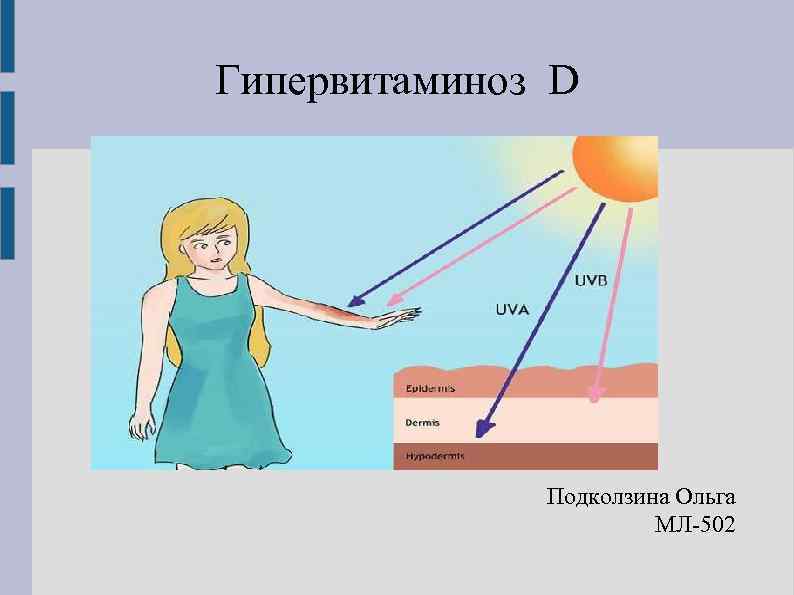 Гипервитаминоз D Подколзина Ольга МЛ-502 