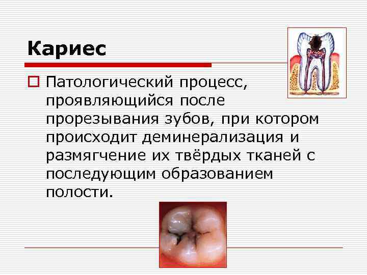 Кариес o Патологический процесс, проявляющийся после прорезывания зубов, при котором происходит деминерализация и размягчение