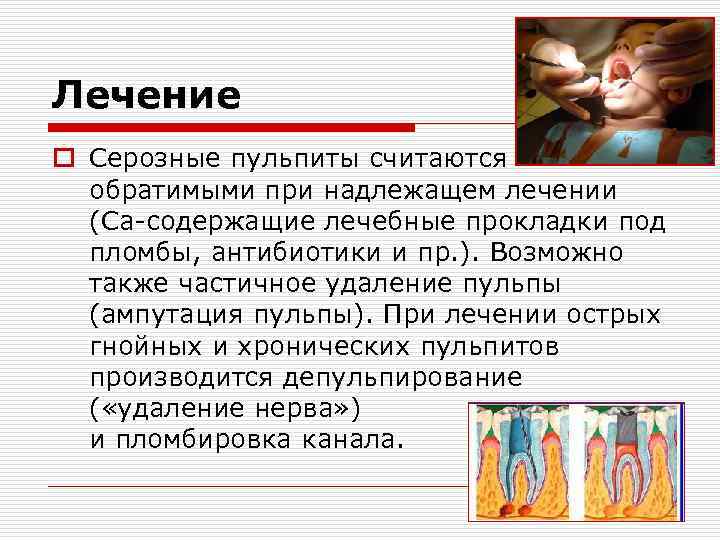 Лечение o Серозные пульпиты считаются обратимыми при надлежащем лечении (Ca-содержащие лечебные прокладки под пломбы,