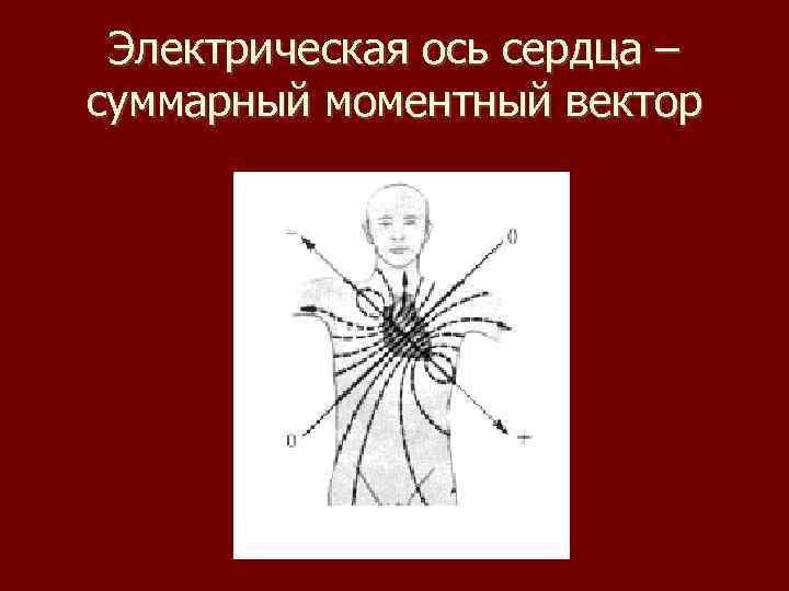 Электрическая ось сердца – суммарный моментный вектор 