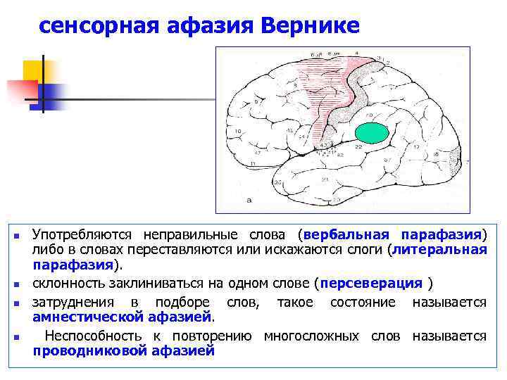 Сенсорная афазия