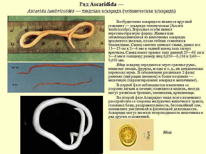 Ряд Ascaridida — Ascarida lumbricoides — людська аскарида (человеческая аскарида) Возбудителем аскаридоза является круглый