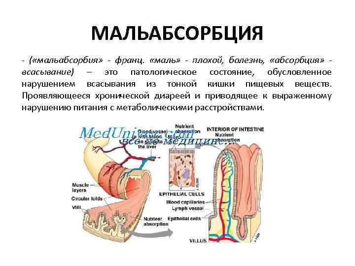 МАЛЬАБСОРБЦИЯ - ( «мальабсорбия» - франц. «маль» - плохой, болезнь, «абсорбция» всасывание) – это