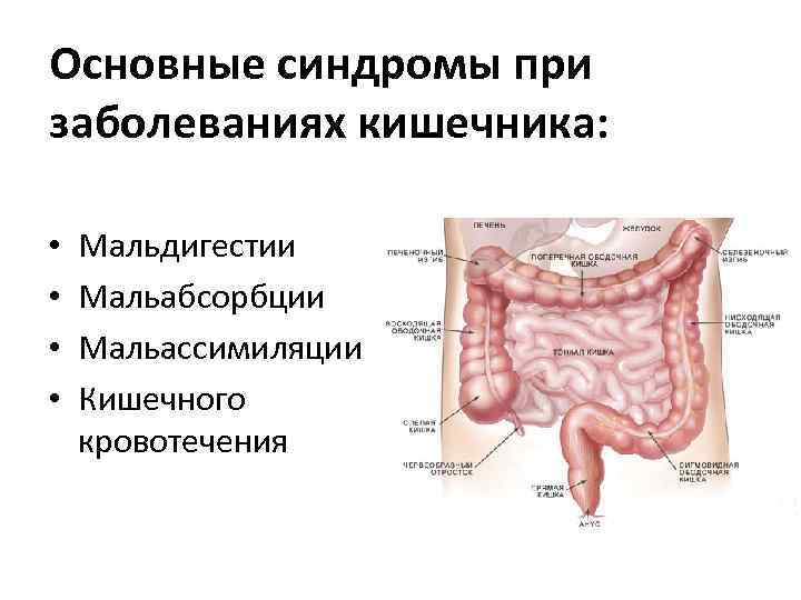 Основные синдромы при заболеваниях кишечника: • • Мальдигестии Мальабсорбции Мальассимиляции Кишечного кровотечения 