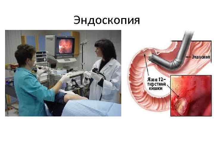 Эндоскопия 