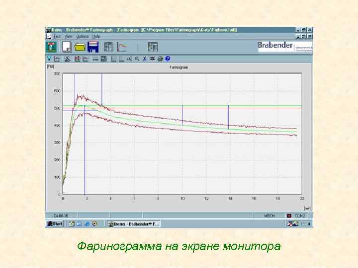 Фаринограмма на экране монитора 