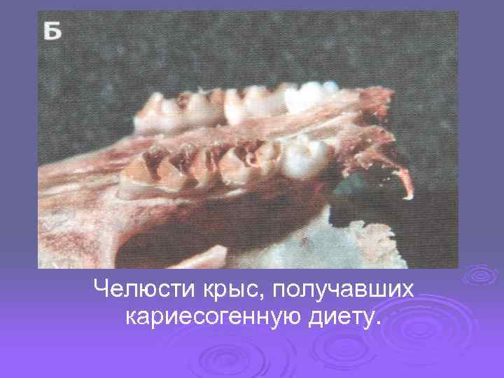 Челюсти крыс, получавших кариесогенную диету. 