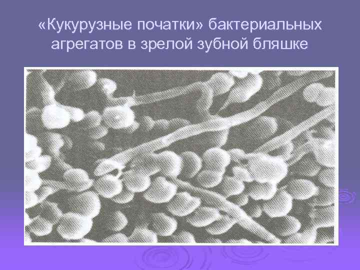  «Кукурузные початки» бактериальных агрегатов в зрелой зубной бляшке 
