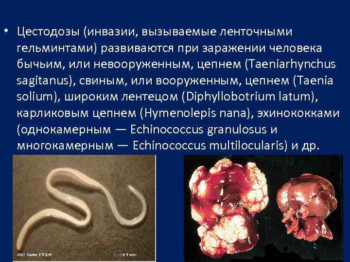  • Цестодозы (инвазии, вызываемые ленточными гельминтами) развиваются при заражении человека бычьим, или невооруженным,