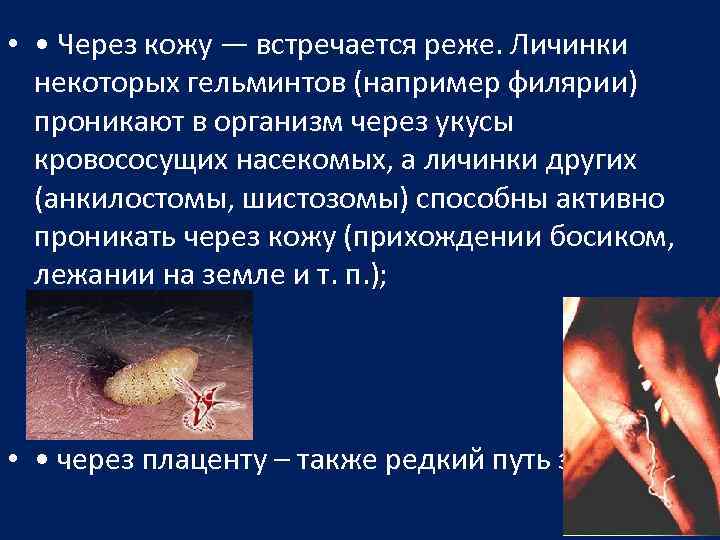  • • Через кожу — встречается реже. Личинки некоторых гельминтов (например филярии) проникают