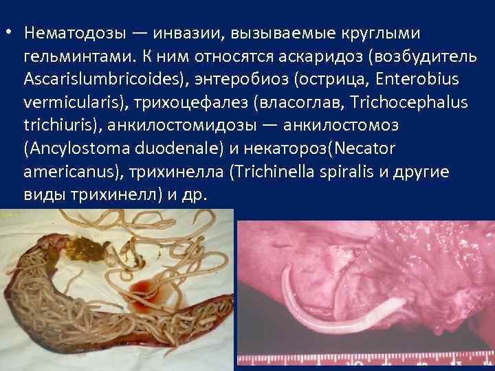  • Нематодозы — инвазии, вызываемые круглыми гельминтами. К ним относятся аскаридоз (возбудитель Ascarislumbricoides),