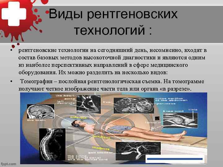 Виды рентгеновских технологий : • рентгеновские технологии на сегодняшний день, несомненно, входят в состав