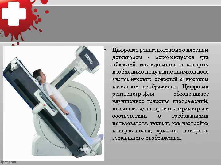  • Цифровая рентгенография с плоским детектором - рекомендуется для областей исследования, в которых
