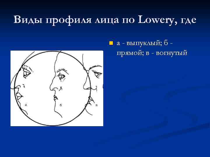 Виды профиля лица по Lowery, где n а - выпуклый; б прямой; в -