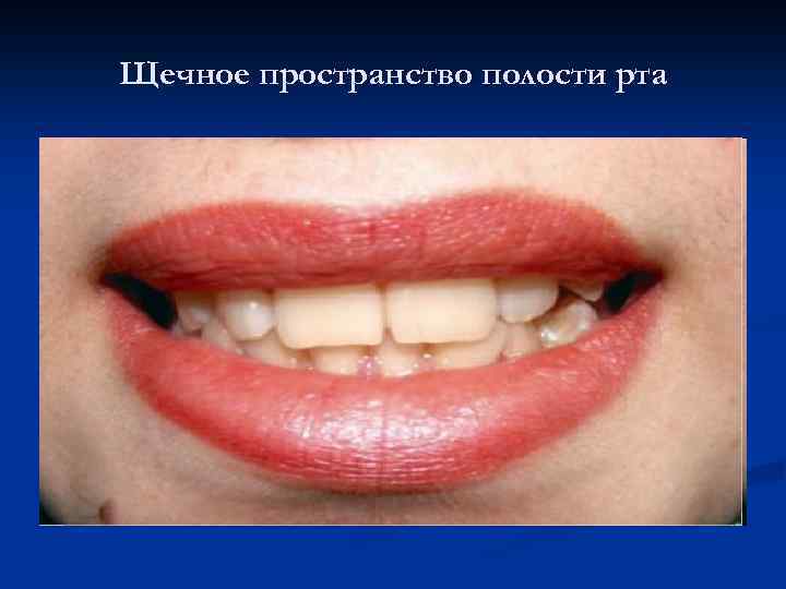 Щечное пространство полости рта 