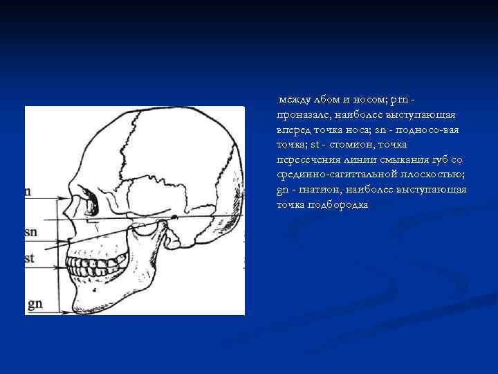 между лбом и носом; prn проназале, наиболее выступающая вперед точка носа; sn - подносо-вая