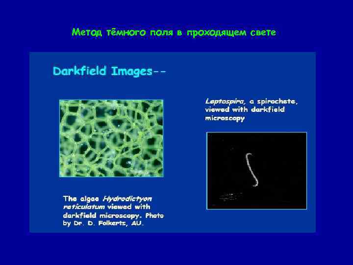 В методе темного поля микроскопии изображение объекта получается