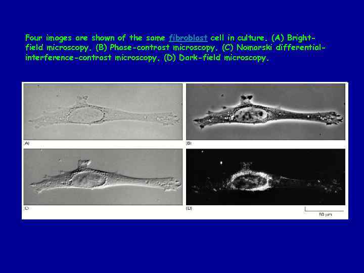 Four images are shown of the same fibroblast cell in culture. (A) Brightfield microscopy.