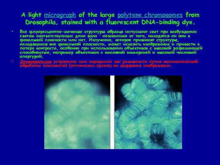 A light micrograph of the large polytene chromosomes from Drosophila, stained with a fluorescent