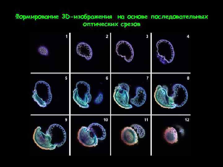 Формирование 3 D-изображения на основе последовательных оптических срезов 