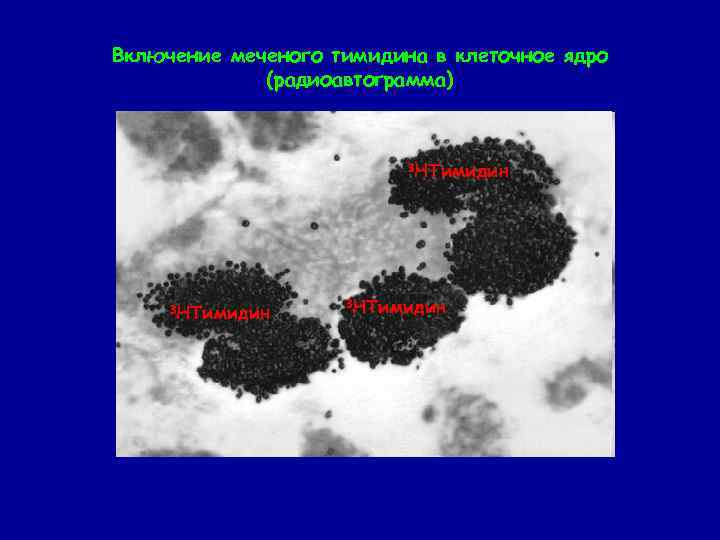 Включение меченого тимидина в клеточное ядро (радиоавтограмма) 3 НТимидин 