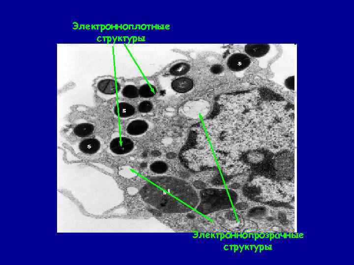 Электронноплотные структуры Электроннопрозрачные структуры 