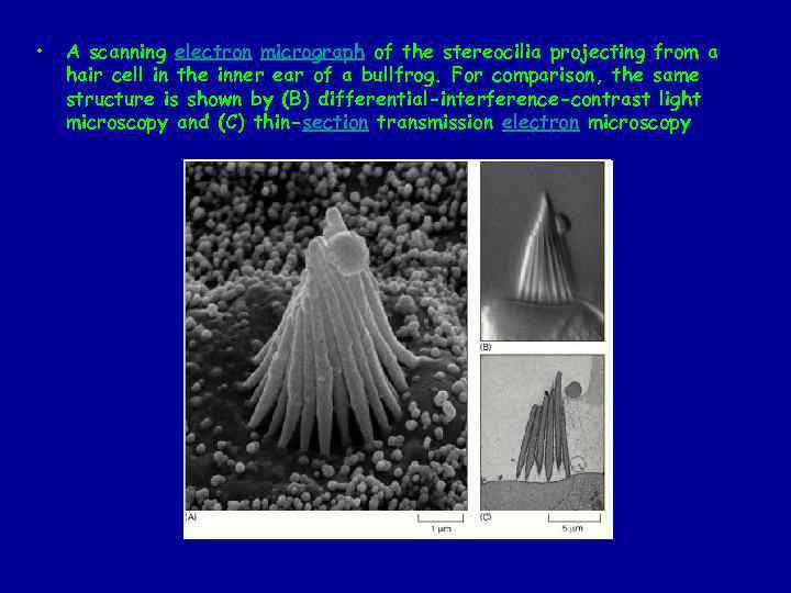  • A scanning electron micrograph of the stereocilia projecting from a hair cell