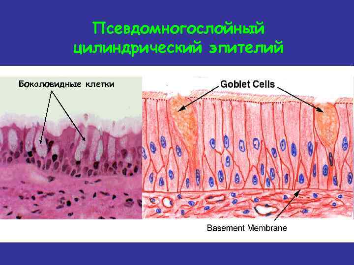Псевдомногослойный цилиндрический эпителий Бокаловидные клетки 