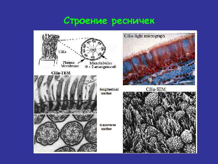 Строение реснички гистология. Ультрамикроскопическое строение реснички. Формула ресничек гистология. Микростроение реснички ткани.