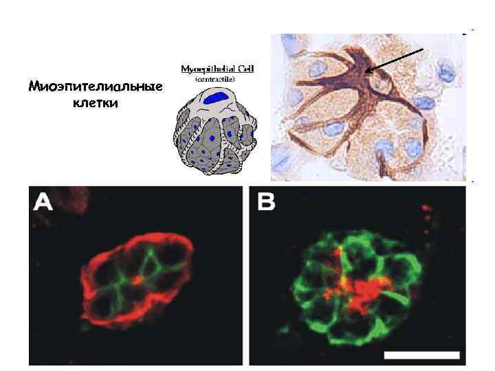 Миоэпителиальные клетки 