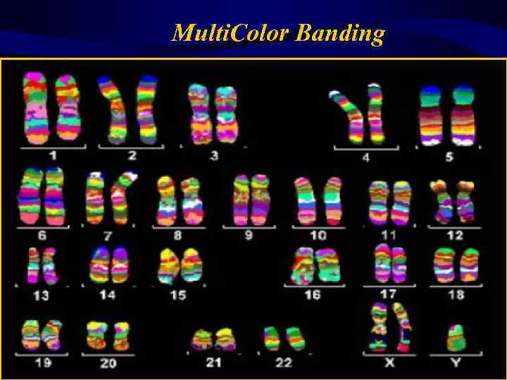 Multi. Color Banding 