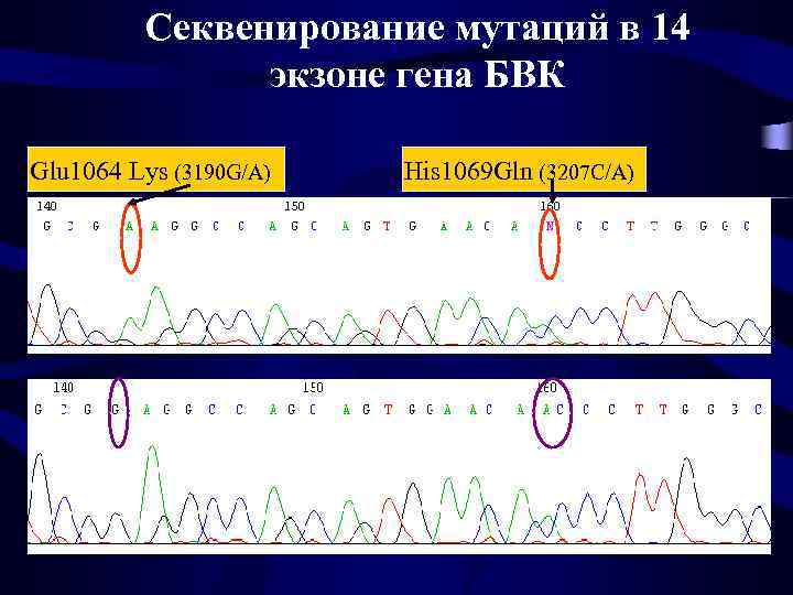Секвенирование мутаций в 14 экзоне гена БВК Glu 1064 Lys (3190 G/A) His 1069