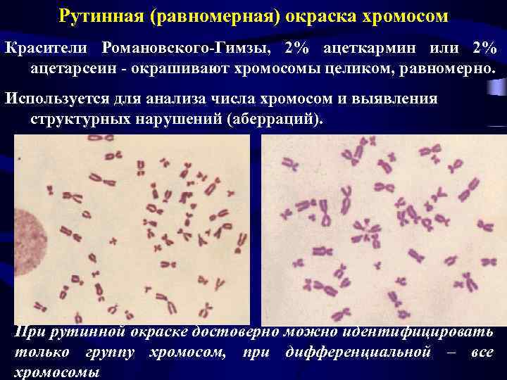 Окраска хромосом