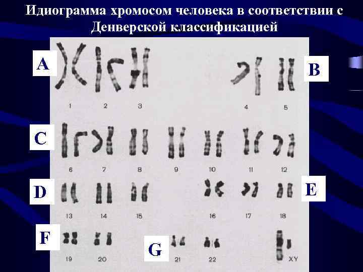Идиограмма хромосом человека в соответствии с Денверской классификацией A B C E D F