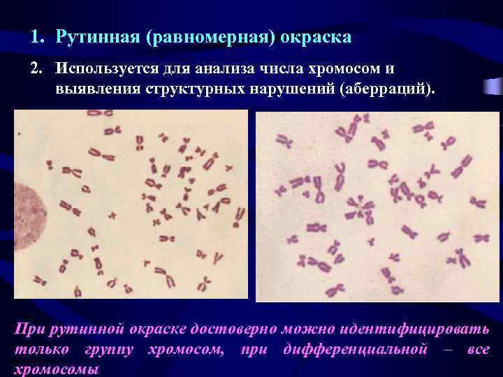 1. Рутинная (равномерная) окраска 2. Используется для анализа числа хромосом и выявления структурных нарушений