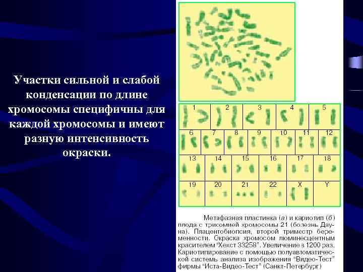 Цитогенетический метод картинки