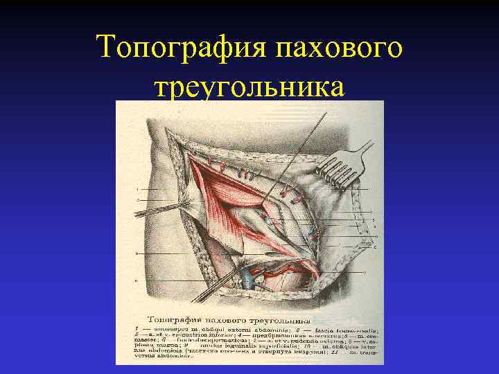 Схема топографии пахового канала