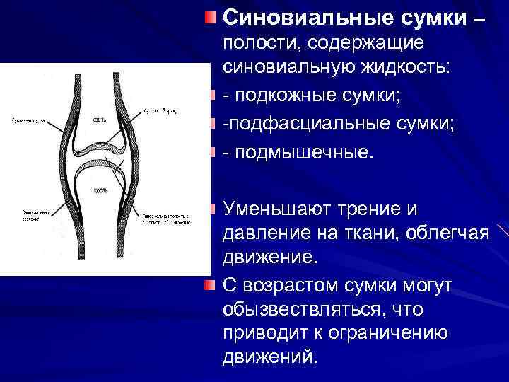 Синовиальная сумка