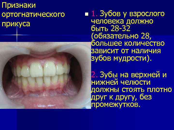 Признаки ортогнатического прикуса n 1. Зубов у взрослого человека должно быть 28 -32 (обязательно