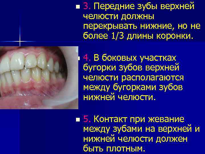 n 3. Передние зубы верхней челюсти должны перекрывать нижние, но не более 1/3 длины