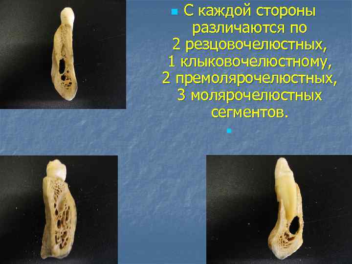 С каждой стороны различаются по 2 резцовочелюстных, 1 клыковочелюстному, 2 премолярочелюстных, 3 молярочелюстных сегментов.